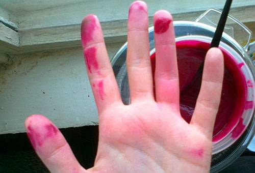 Fucorcine taches sur la main