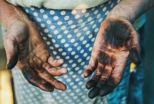 taches sur les mains des noix