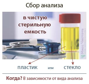 Collection d'analyses d'urine