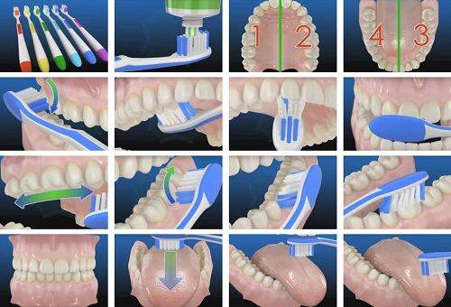 séquence de brossage