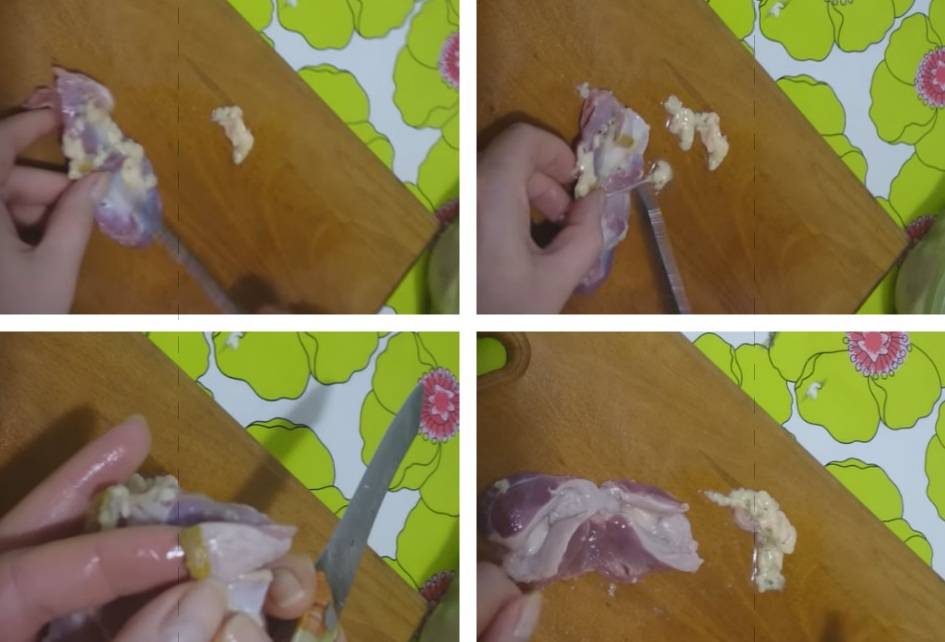 nettoyage ventriculaire