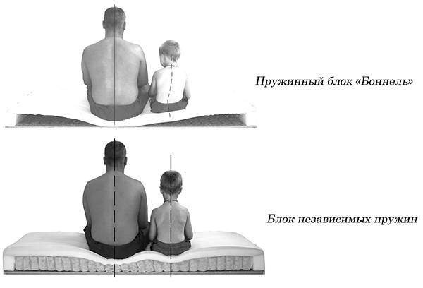 Inconvénients de Bonnel Blocks