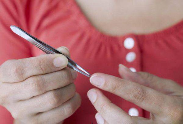 Extraction de pincettes par pincettes