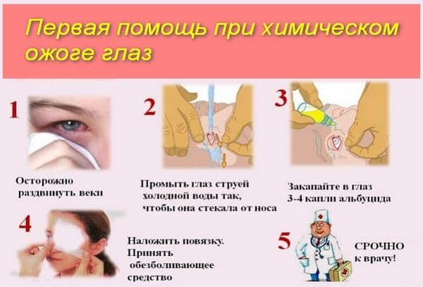 Aide avec une brûlure chimique