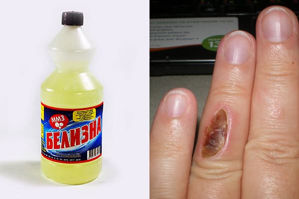 Brûler un doigt de blanc