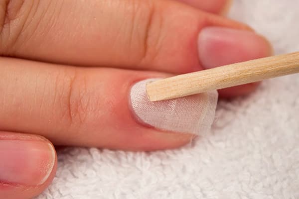 Restauration d'un ongle cassé